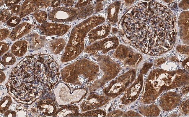 Anti-PLD2 Antibody, clone 6F13 ZooMAb<sup>®</sup> Rabbit Monoclonal