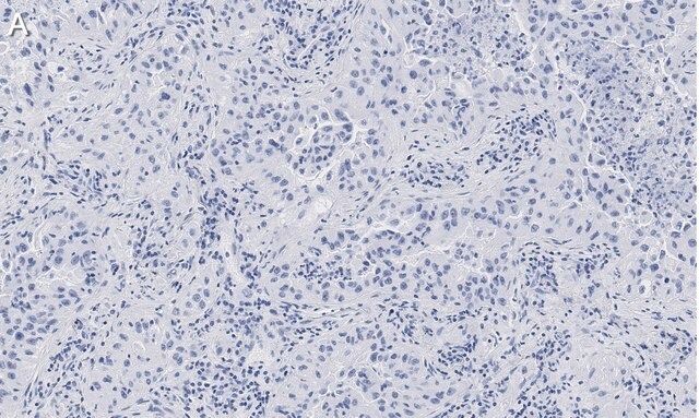 Anti-Integrin pan-αV Antibody, clone EM01309 , ZooMAb<sup>®</sup> Rabbit Monoclonal