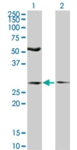 Monoclonal Anti-IFT57 antibody produced in mouse