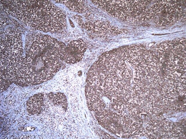 Anti-Desert hedgehog protein (DHH) Antibody, clone 19D7.2
