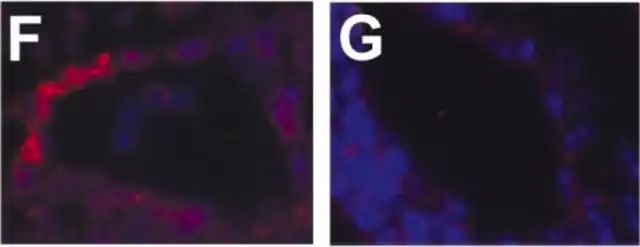 Monoclonal Anti-Actin, α-Smooth Muscle