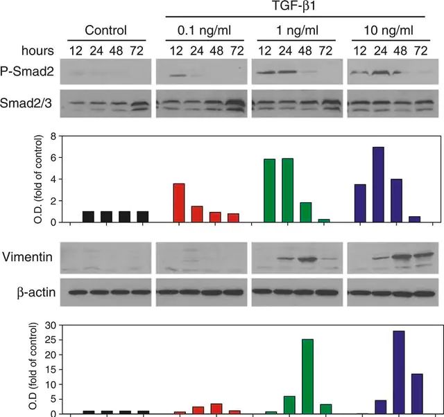 Monoclonal Anti-β-Actin antibody produced in mouse