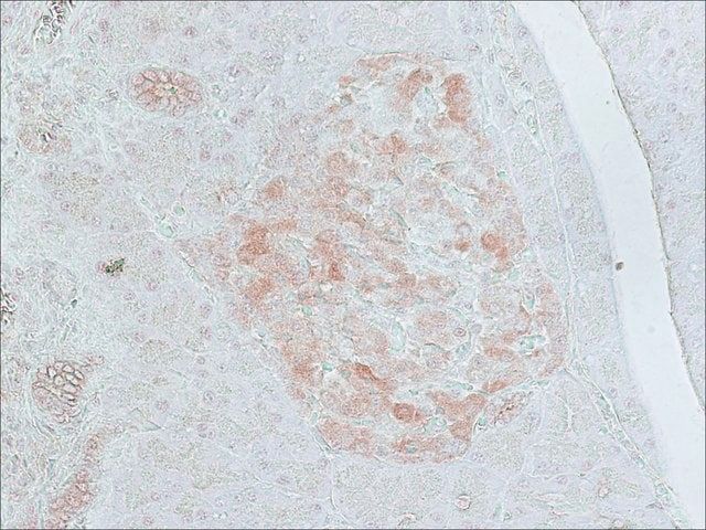 Anti-Glutamic Acid Decarboxylase 65 (514-530) antibody produced in rabbit