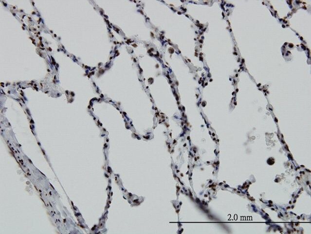 Monoclonal Anti-VDR antibody produced in mouse