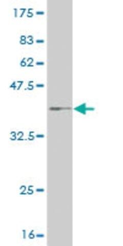 Monoclonal Anti-CPT2 antibody produced in mouse