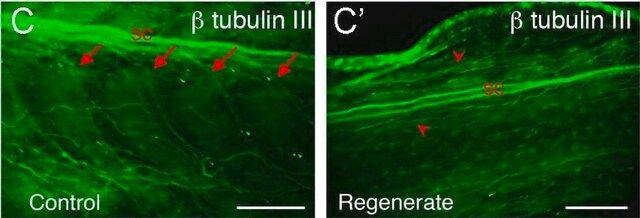 Anti-β-Tubulin III antibody produced in rabbit