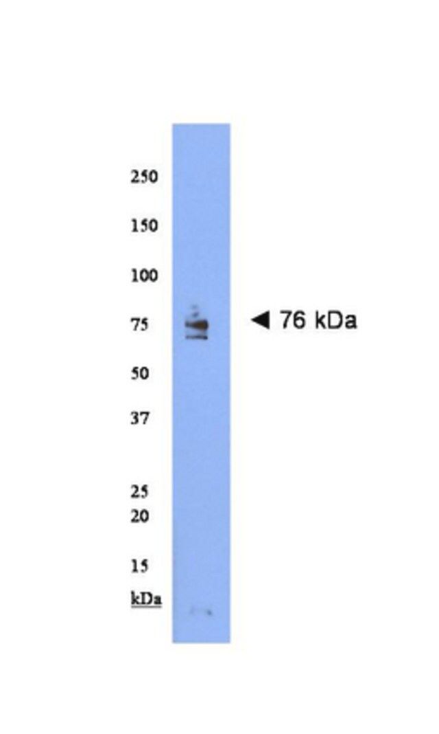 Anti-NARC-1 Antibody