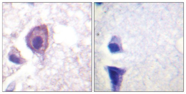 Anti-CD4 antibody produced in rabbit