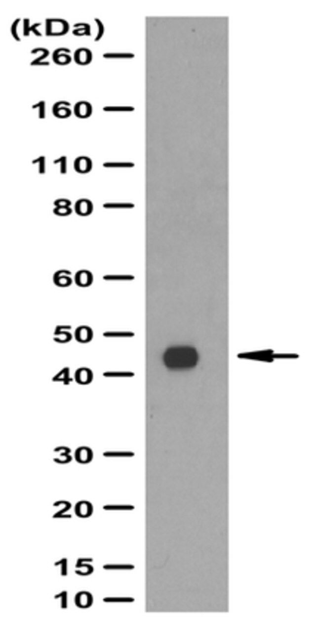 Anti-PAR-4 Antibody