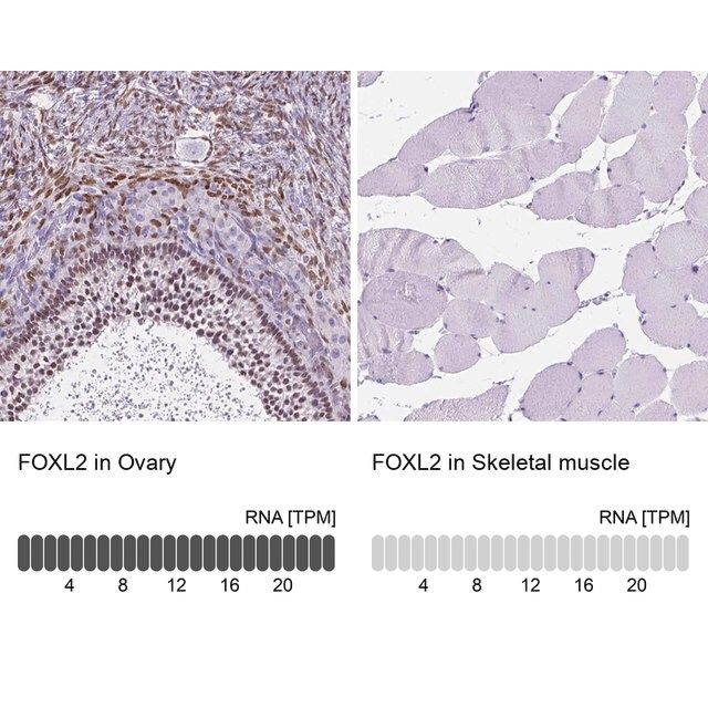 Anti-FOXL2 antibody produced in rabbit