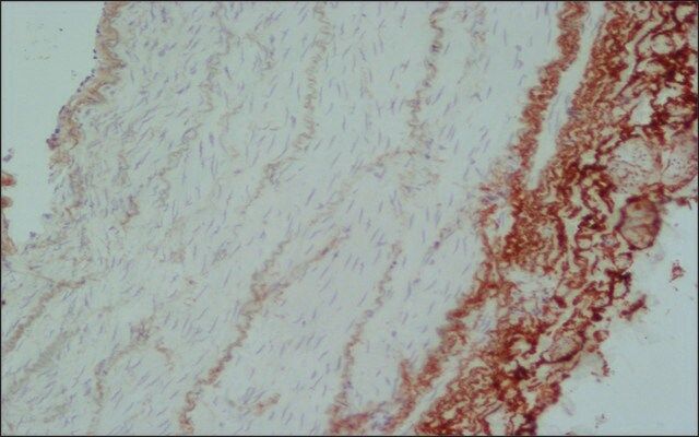 Anti-Elastin antibody, Mouse monoclonal