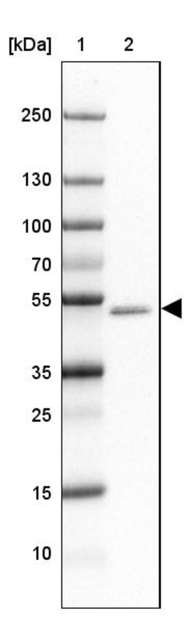 Anti-GABRA1 antibody produced in rabbit
