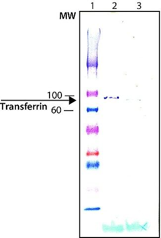 Anti-Transferrin antibody produced in chicken