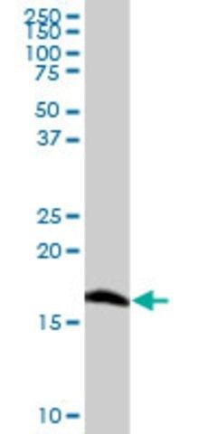 Anti-SOD1 antibody produced in mouse