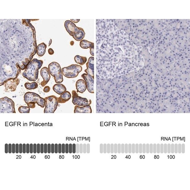 Anti-EGFR antibody produced in rabbit