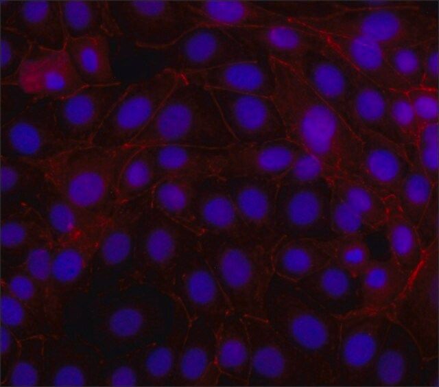 Anti-β-Catenin-Cy3 antibody, Mouse monoclonal