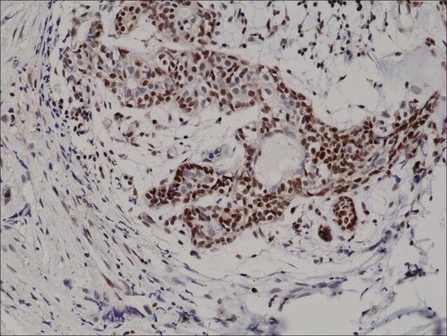 Anti-p27Kip1antibody, Rabbit Monoclonal