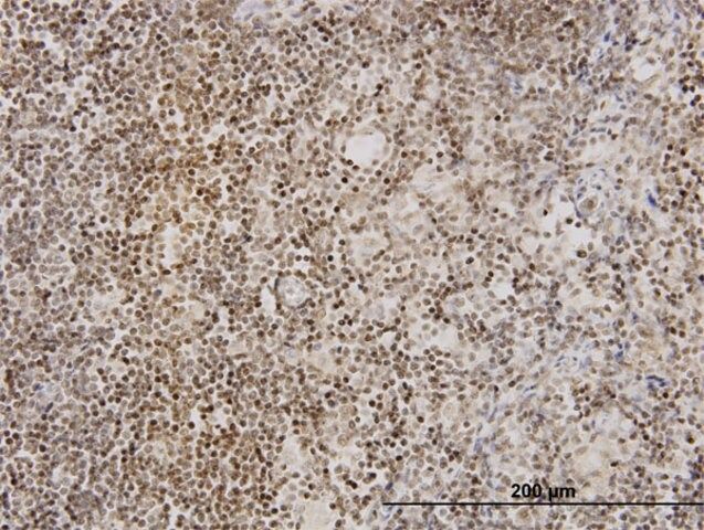 Monoclonal Anti-TNKS antibody produced in mouse