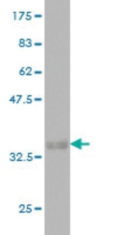Monoclonal Anti-RNF125 antibody produced in mouse