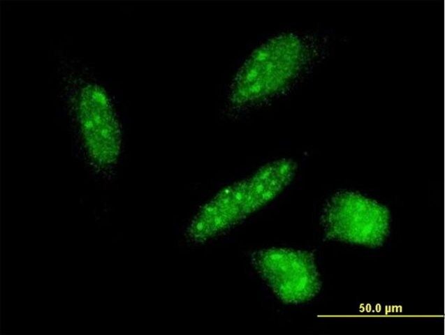 Monoclonal Anti-RNF24 antibody produced in mouse