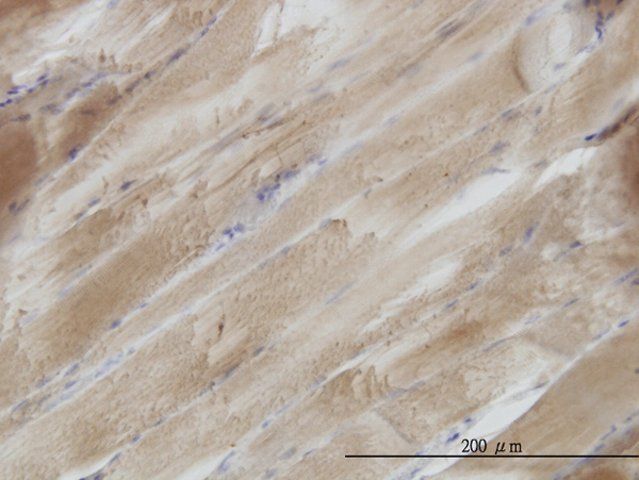 Monoclonal Anti-SH3BGR antibody produced in mouse