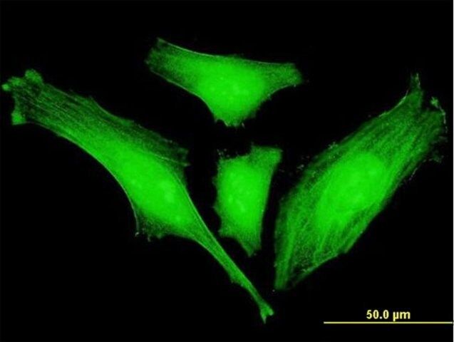 Monoclonal Anti-SLC2A4RG antibody produced in mouse