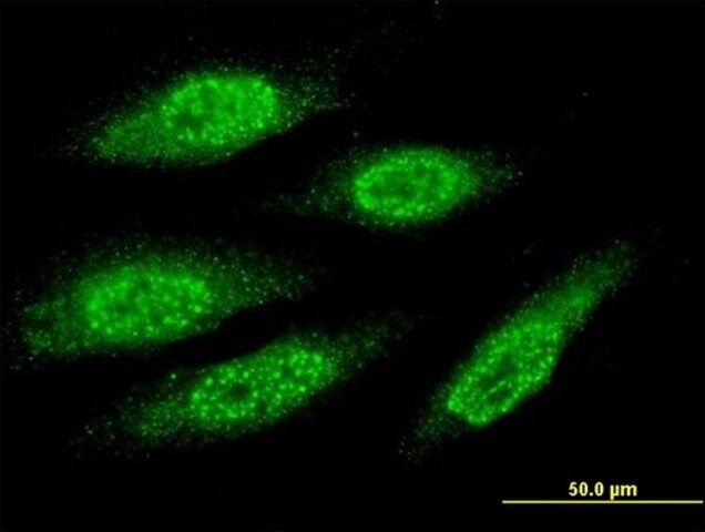 Monoclonal Anti-MAGEA8 antibody produced in mouse