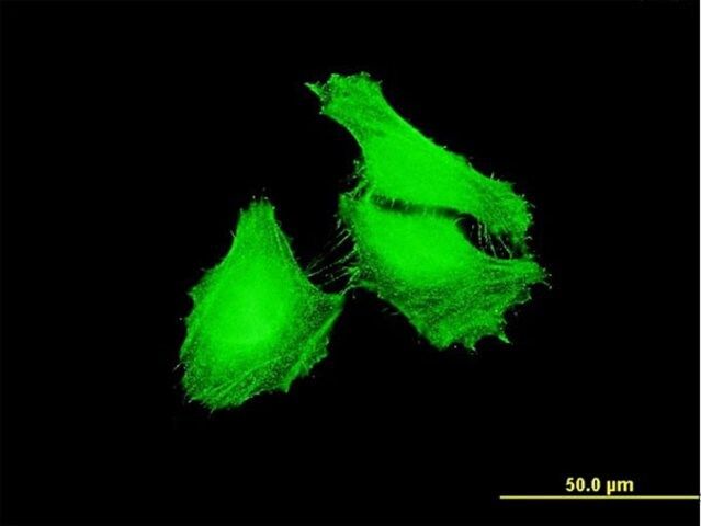 Monoclonal Anti-FBXL22 antibody produced in mouse
