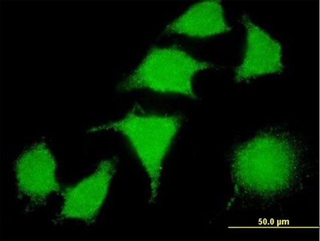 Monoclonal Anti-LIMK2 antibody produced in mouse