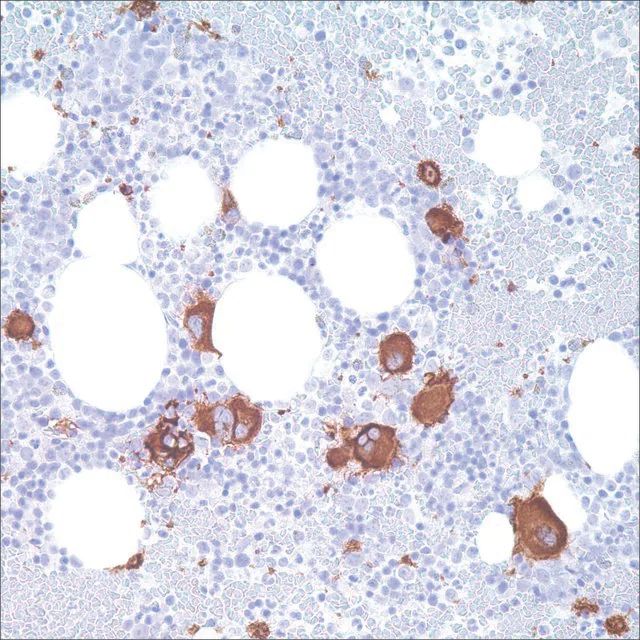 CD61 (2f2) Mouse Monoclonal Antibody