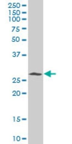 Monoclonal Anti-CDK5 antibody produced in mouse