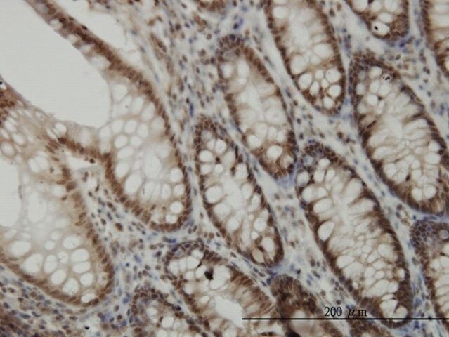 Monoclonal Anti-CDK6 antibody produced in mouse