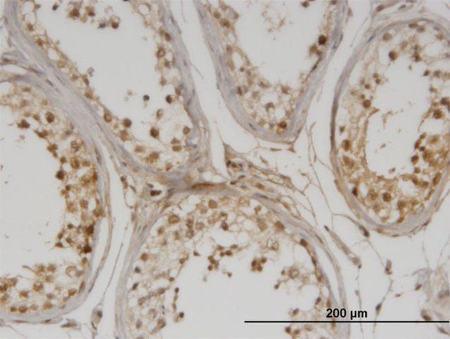 Monoclonal Anti-DMAP1 antibody produced in mouse