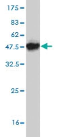 Monoclonal Anti-ACP1 antibody produced in mouse