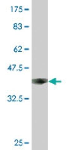 Monoclonal Anti-ACO1 antibody produced in mouse
