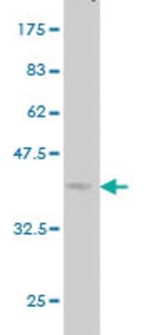 Monoclonal Anti-ACVRL1 antibody produced in mouse
