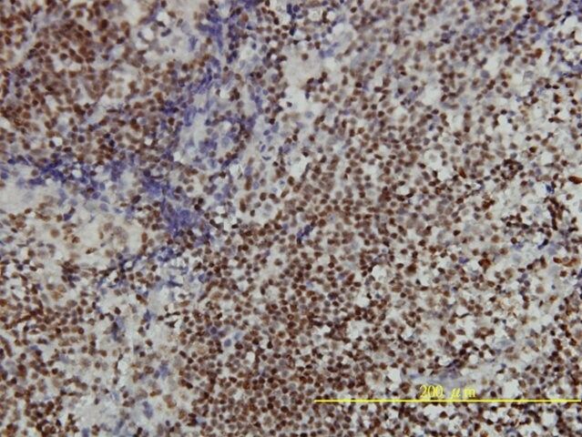 Monoclonal Anti-ANP32A antibody produced in mouse