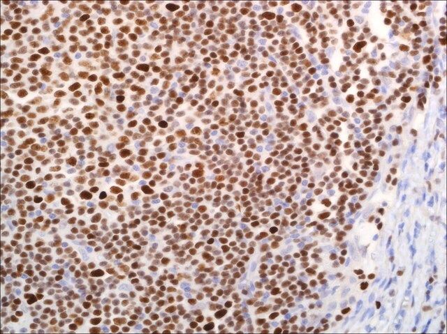 LEF1(EP310) Rabbit Monoclonal Primary Antibody