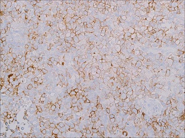 PD-1 (EP239) Rabbit Monoclonal Primary Antibody