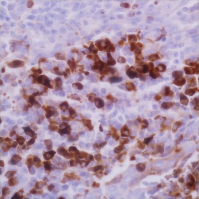 Kappa (EP171) Rabbit Monoclonal Primary Antibody