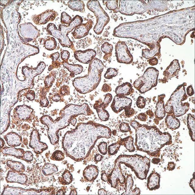 hCG Rabbit Polyclonal Antibody