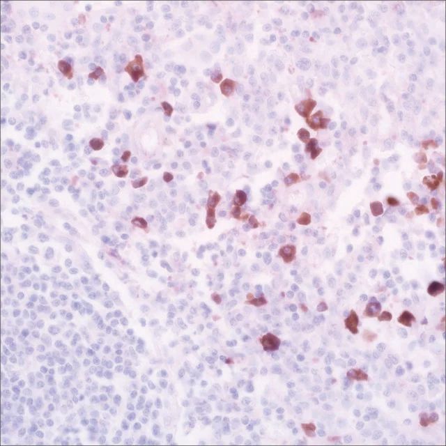 IgA (EP170) Rabbit Monoclonal Primary Antibody