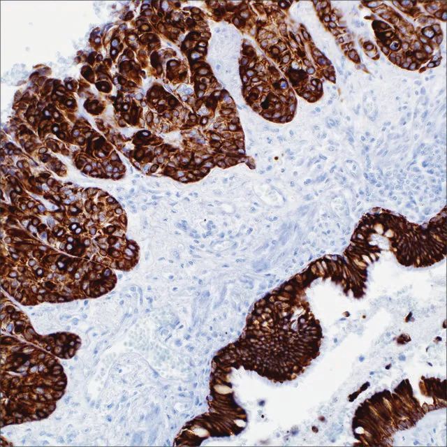Cytokeratin (OSCAR) Mouse Monoclonal Antibody