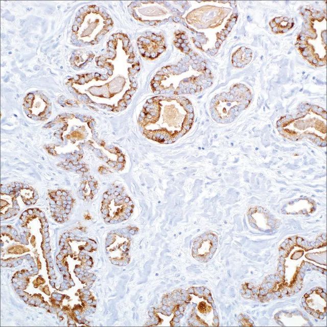 Cytokeratin, LMW (AE1) Mouse Monoclonal Antibody