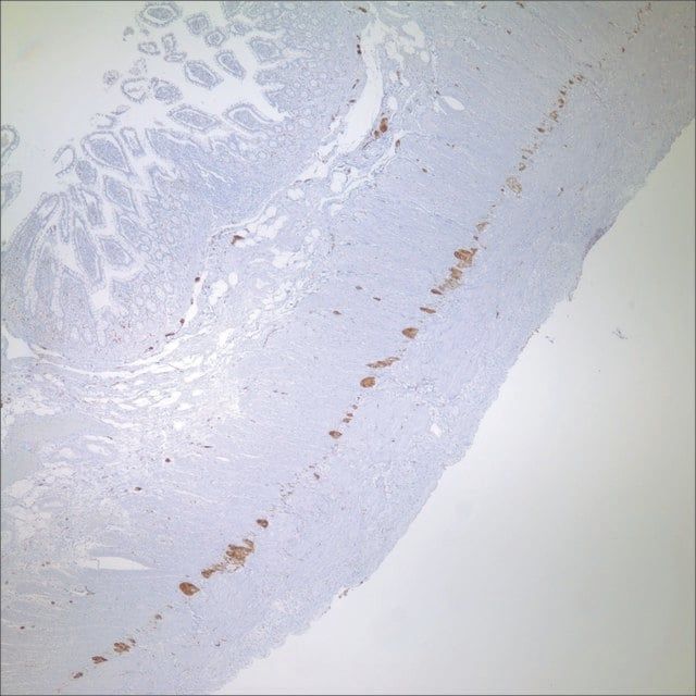 PGP 9.5 Rabbit Polyclonal Antibody