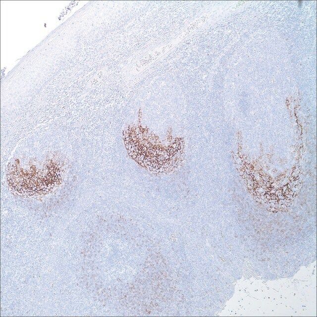 CD23 (1B12) Mouse Monoclonal Antibody