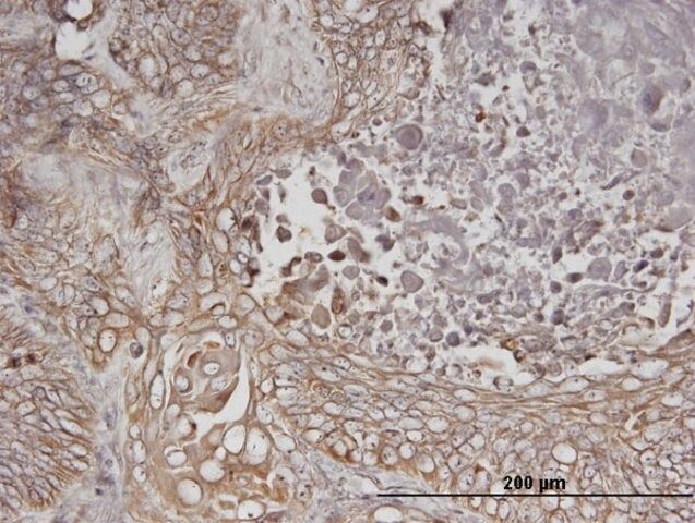 Monoclonal Anti-ERBB3 antibody produced in mouse