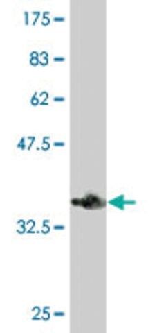 Monoclonal Anti-HIP1R antibody produced in mouse