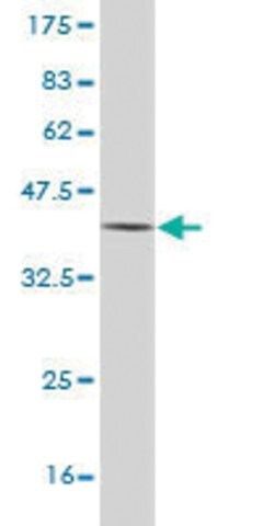Monoclonal Anti-AADAC antibody produced in mouse