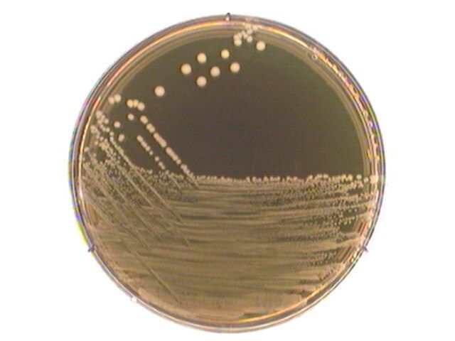 M 17 agar acc. to TERZAGHI